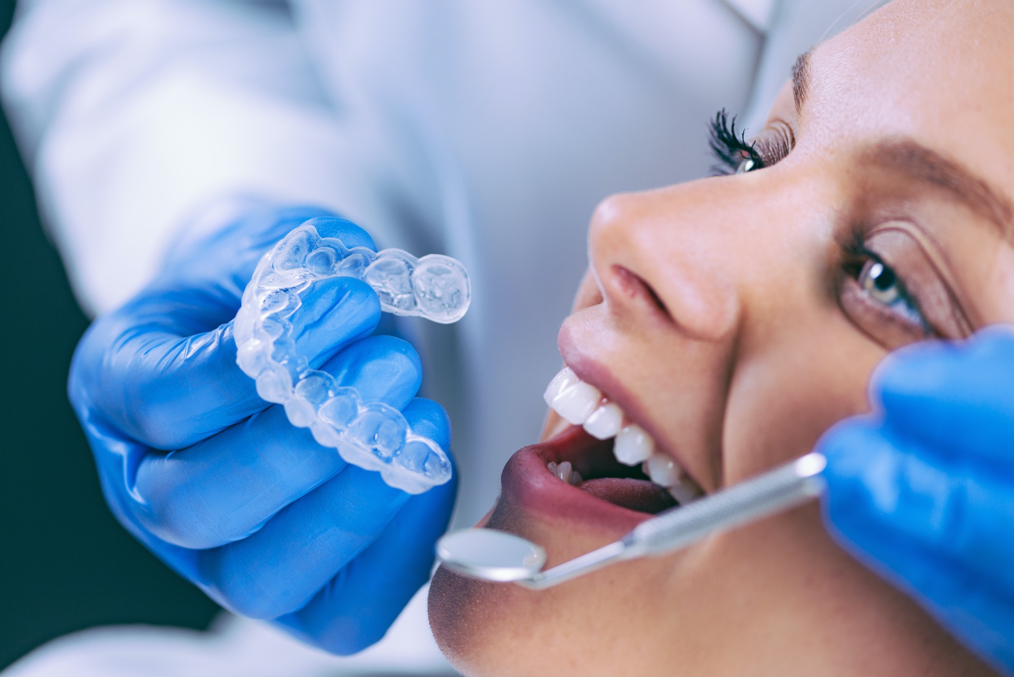 teeth-whitening-procedure.jpg